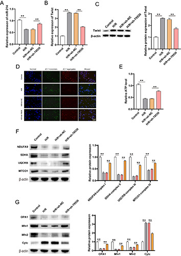 circRNA-79530 regulates Twist-mediated mitochondrial damage <i>via s</i>ponging miR-214 affecting hypoxia/reoxygenation-induced injury in H9c2 cardiomyocytes.