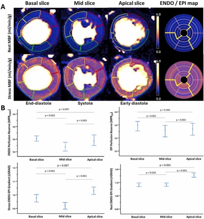 Normal values of high-resolution transmural perfusion distribution metrics for automated quantitative pixel-wise myocardial perfusion cardiovascular magnetic resonance.