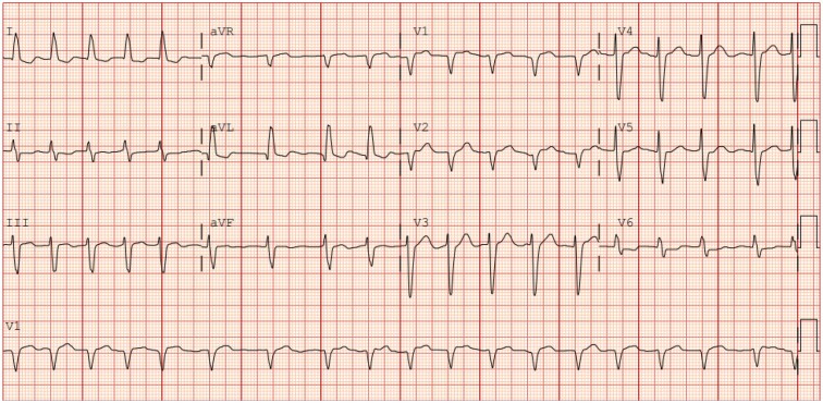 The hope and the hype of artificial intelligence for syncope management.