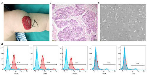 Effects of Notch signaling on proliferation, angiogenesis, and adipogenesis of hemangioma-derived stem cells.
