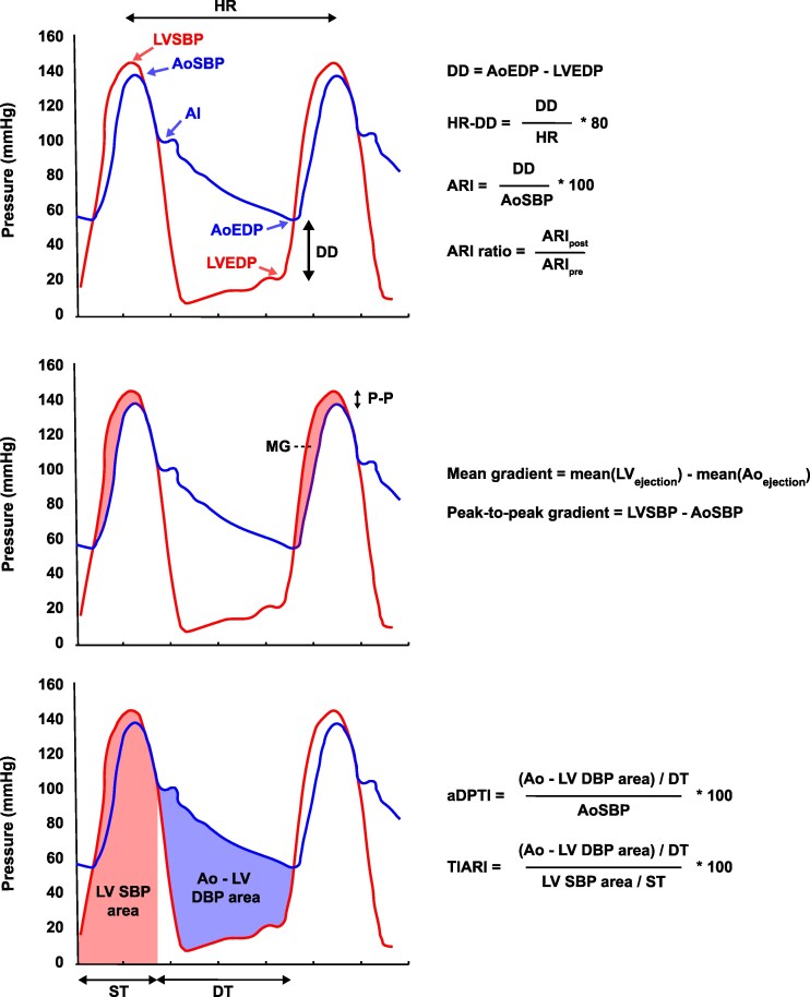 Construct validity of automated assessment of invasively measured hemodynamics during transcatheter aortic valve replacement.