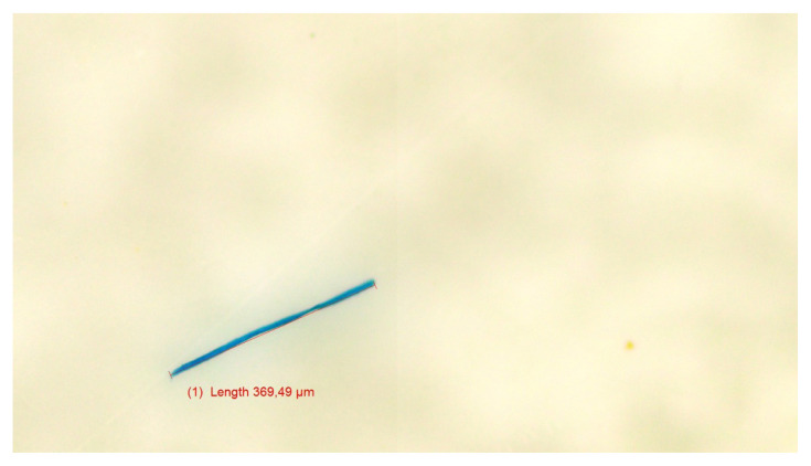 Detection and quantification of microplastics in cerumen.