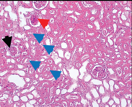 The protective and therapeutic roles of green tea extract on body weight, inflammatory markers, renal function, oxidative stress, and kidney histopathology in rats treated with gentamicin.