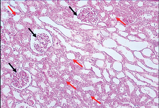 The protective and therapeutic roles of green tea extract on body weight, inflammatory markers, renal function, oxidative stress, and kidney histopathology in rats treated with gentamicin.