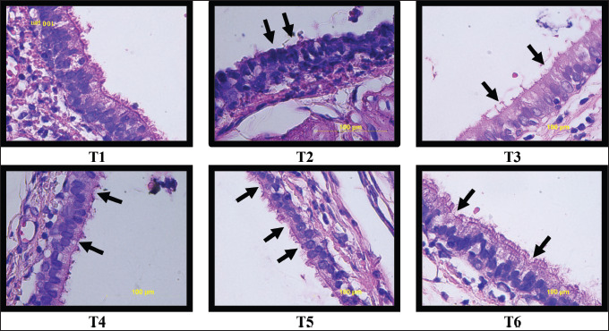 Therapeutic effects of single-clove garlic extract on nicotine-induced inflammation and histopathological changes in rats.