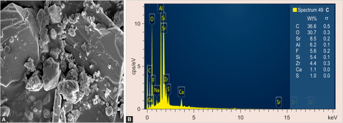 Effects of Thermocycling on Antimicrobial Activity, Contact Angle, Surface Roughness, and Microhardness of Nanomodified Glass Ionomer Cement: An <i>In Vitro</i> Analysis.