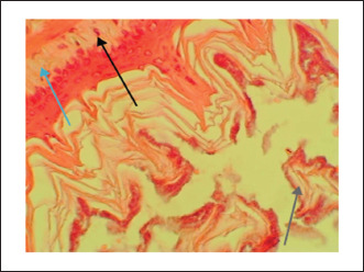 Antiulcer activity of <i>Prosopis farcta</i> L. fruits extract in rats.