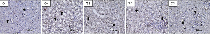 Astaxanthin improves hematology, interleukin-6, and tumor necrosis factor-α in the albino rats' kidney model of dexamethasone toxicity.