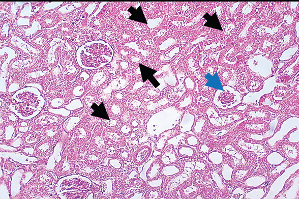 The protective and therapeutic roles of green tea extract on body weight, inflammatory markers, renal function, oxidative stress, and kidney histopathology in rats treated with gentamicin.