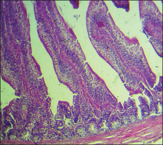The identification of <i>Salmonella enteritidis</i> infection and therapeutic influence of fruit <i>Cordia myxa</i> and curcumin extracts on broiler chickens.