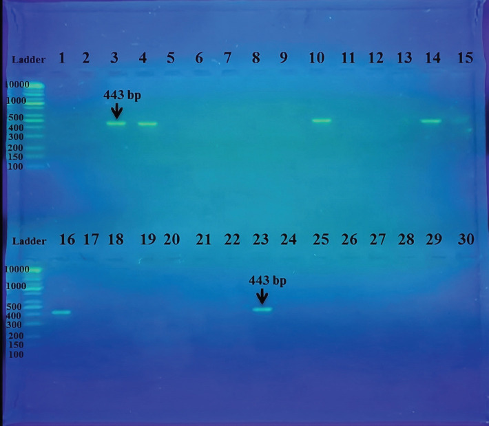 Serologic and molecular survey of <i>Toxoplasma gondii</i> in Baghdad Province, Iraq.