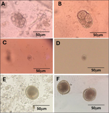 Gastrointestinal parasite infection and the first molecular detection of strongyle infection in cattle of the Ayeyarwaddy Division, Myanmar.