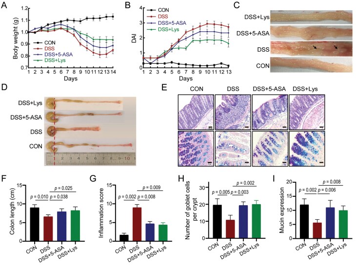 Lysozyme alleviates DSS-induced colitis by modulating pro-inflammatory factors and NF-κB activation.