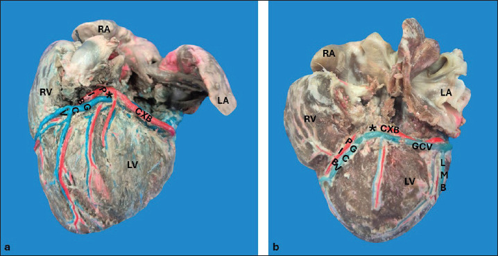 A direct anatomical characterization of the coronary sinus in dogs (<i>Canis lupus</i> familiaris).
