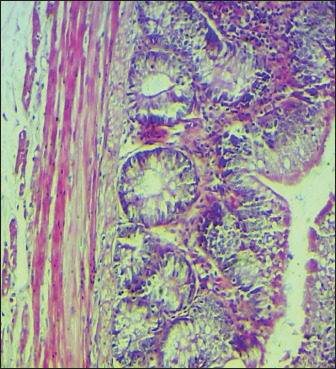 The identification of <i>Salmonella enteritidis</i> infection and therapeutic influence of fruit <i>Cordia myxa</i> and curcumin extracts on broiler chickens.