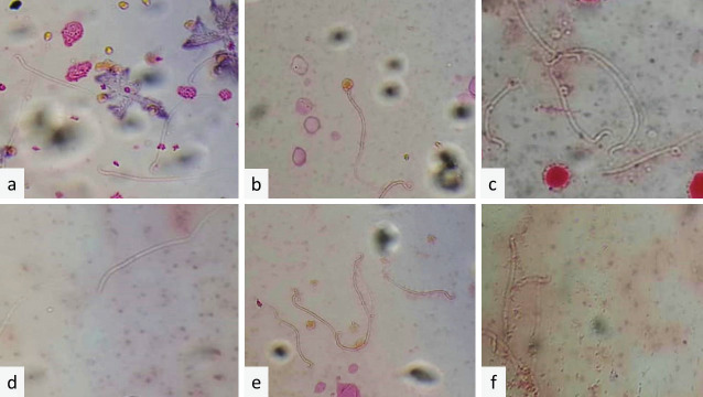 Honey and royal jelly boost sperm parameters, ovarian follicles growth, and steroid hormones in immature rats.