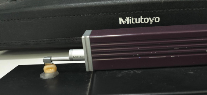 Evaluation of Surface Roughness and Microbial Adhesion of Primary Esthetic Crowns: An <i>In Vitro</i> Study.