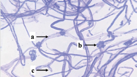 Isolation and identification of local white-rot fungi from West Sumatra and their potential for biodelignification of ruminant feed.