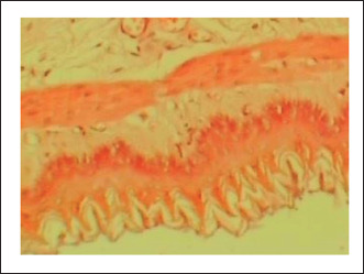 Antiulcer activity of <i>Prosopis farcta</i> L. fruits extract in rats.
