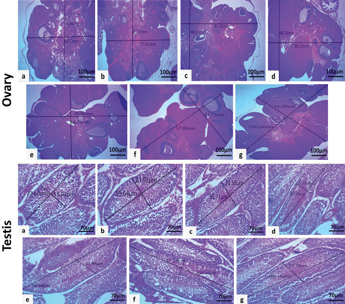 Honey and royal jelly boost sperm parameters, ovarian follicles growth, and steroid hormones in immature rats.