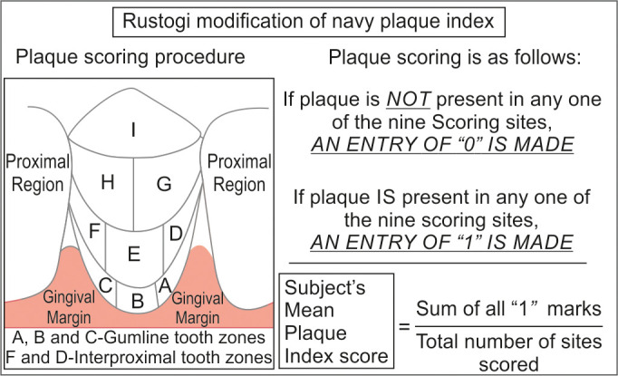 Efficiency of Three Interdental Plaque Control Aids (Dental Floss, Water Flosser, and Interdental Brush) as an Adjunct to Toothbrushing in Children.