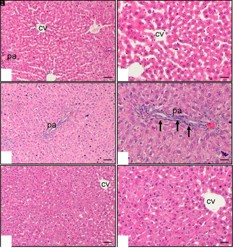Vincamine Mitigates Methotrexate-Induced Liver Fibrosis Model.