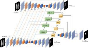 FUNet: Frequency Channel Multi-Modal Fusion and Uncertain Region Adjustment Network for brain tumor segmentation