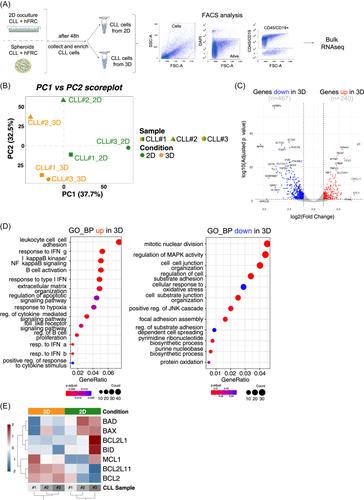 A spheroid model that recapitulates the protective role of the lymph node microenvironment and serves as a platform for drug testing in chronic lymphocytic leukemia