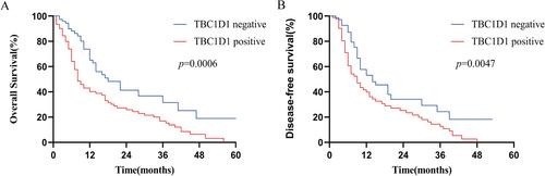 Prognostic Value of TBC1D1 and Its Relationship With the Tumor Microenvironment in Pancreatic Cancer: A Study Based on Single-Cell Sequencing