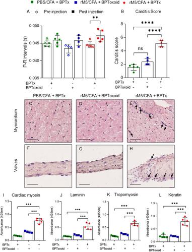 Inflammatory Responses Potentiate GAS M Protein Induced Cardiac Damage in an Experimental Model of Rheumatic Heart Disease