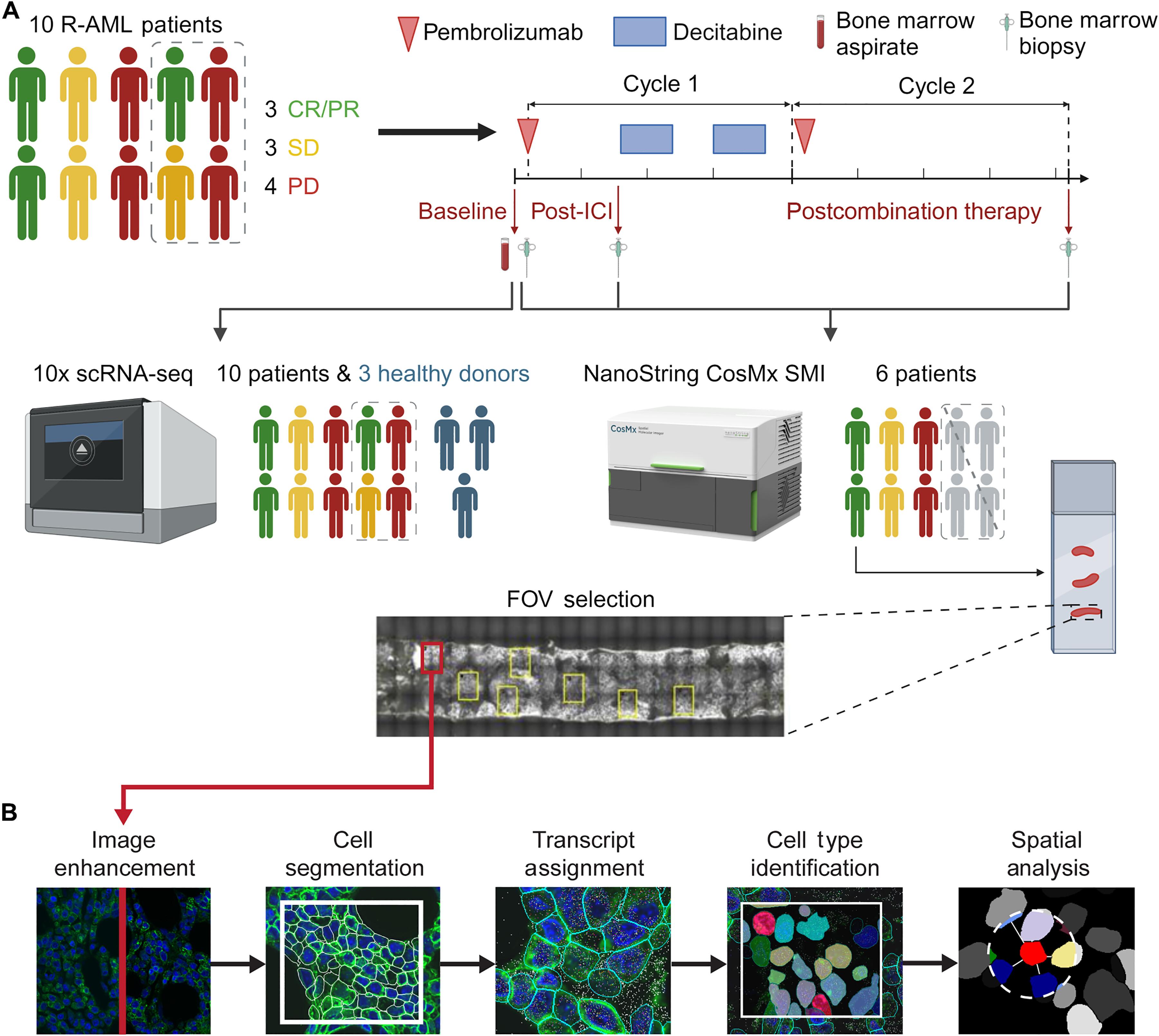 Single-cell spatial transcriptomics reveals immunotherapy-driven bone marrow niche remodeling in AML
