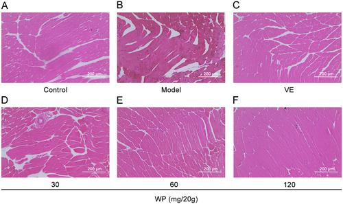 Whey Protein Mitigates Oxidative Stress Injury and Improves Protein Synthesis in Mouse Skeletal Muscle by Regulating the SIRT1/Nrf2/HO-1 Axis and AMPK/TSC2/mTOR/4EBP1 Pathway