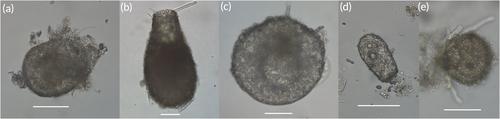Inland Saline Lakes as Hotspots of Specialized, Nonmarine Protist Diversity: The Case of Arcellinida (Amoebozoa)