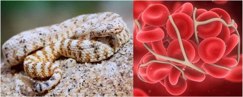 Sometimes size does matter: Anticoagulant pathophysiological effects of Southwestern Speckled Rattlesnake (Crotalus pyrrhus) venoms are dichotomous by body size