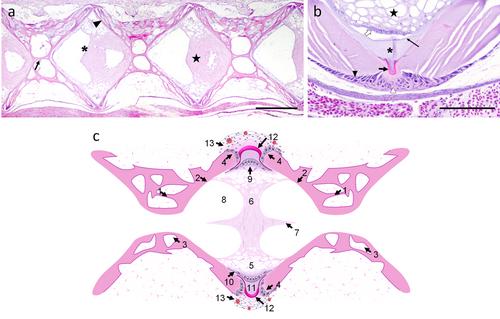 The Vertebral Column of Flatfish: A Review