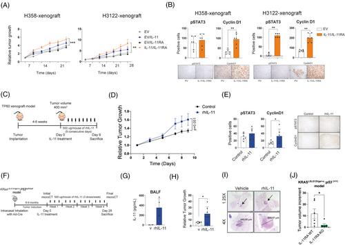 Interleukin-11 promotes lung adenocarcinoma tumourigenesis and immune evasion