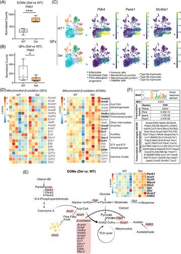 PDK4 and nutrient responses explain muscle specific manifestation in mitochondrial disease