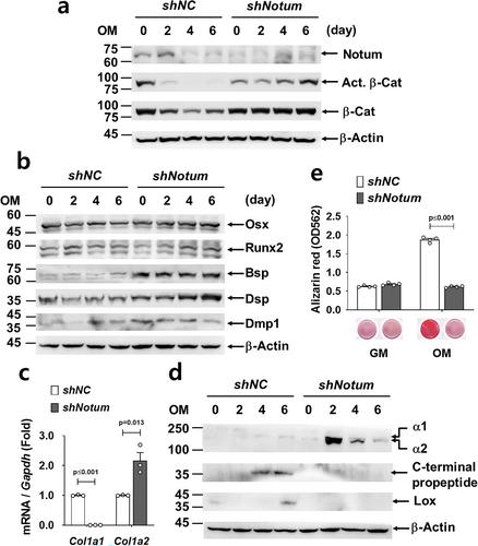 Notum as a Crucial Regulator of Matrix Integrity in Dentinogenesis