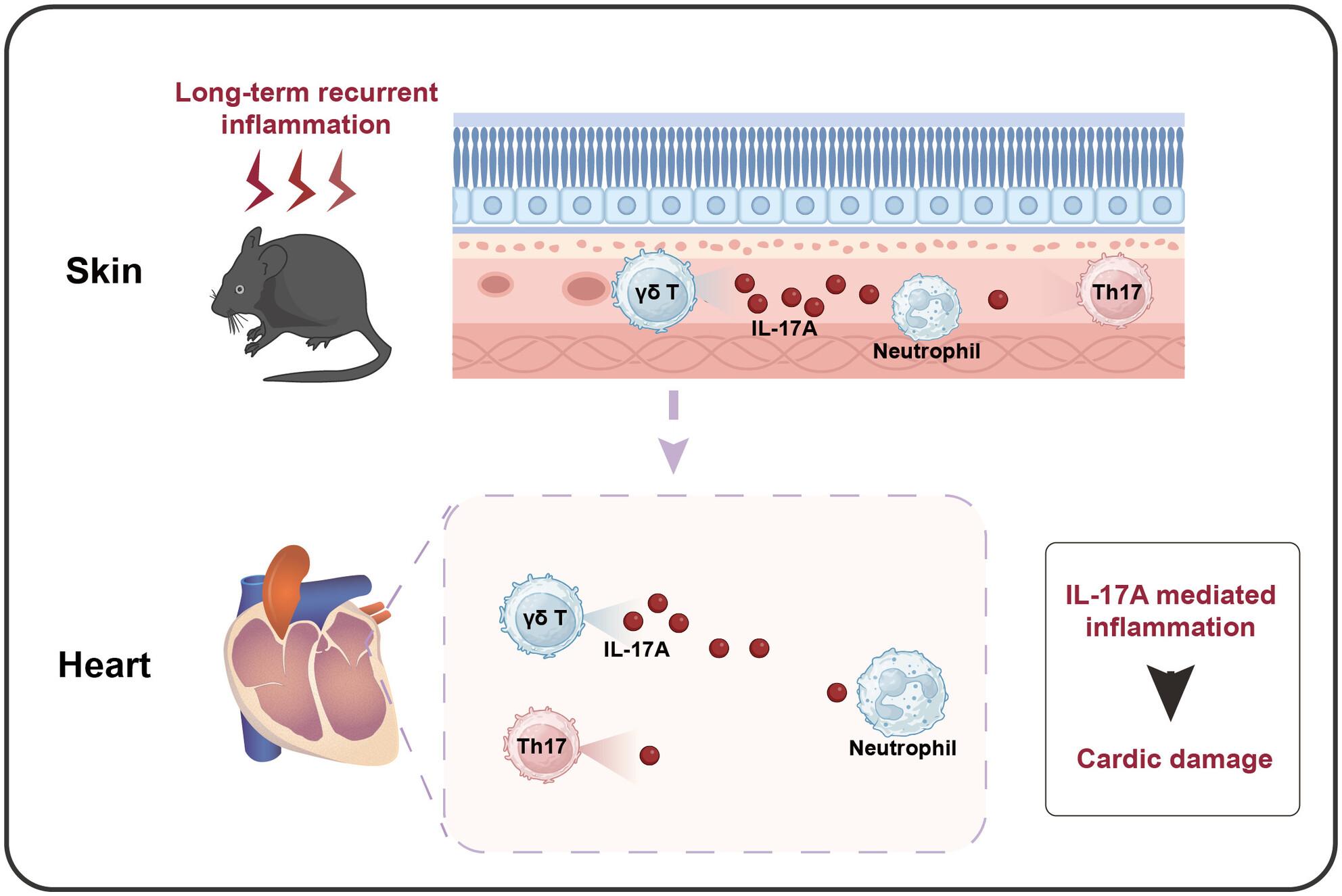 Interleukin-17A-Related Inflammation Mediates Cardiac Injury in Chronic Relapsing Psoriasis-Like Mouse Model