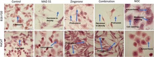Exploring Phytochemical Adjuvant Therapy in Melanoma Treatment: The Effects of MAZ-51 and Zingerone on Melanoma Cell Proliferation