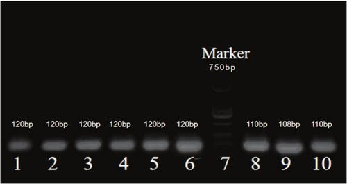 Molecular Marker Discovery and Evaluation: EGF rs1897990 and rs1524106 Variants in a China Lung Adenocarcinoma Young Population