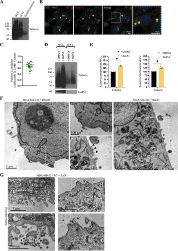 Tethered Exosomes Containing the Matrix Metalloproteinase MT1-MMP Contribute to Extracellular Matrix Degradation