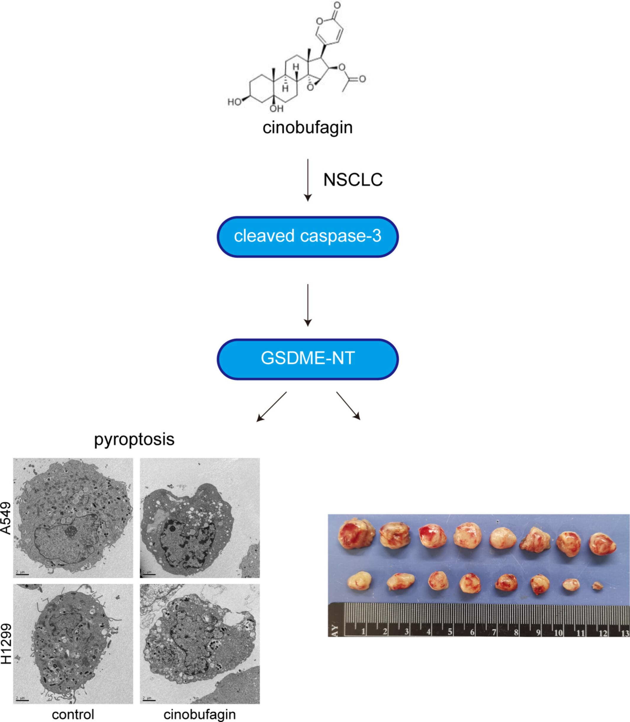 Pyroptosis-Mediated Antitumor Activity of Cinobufagin in Non-Small Cell Lung Cancer