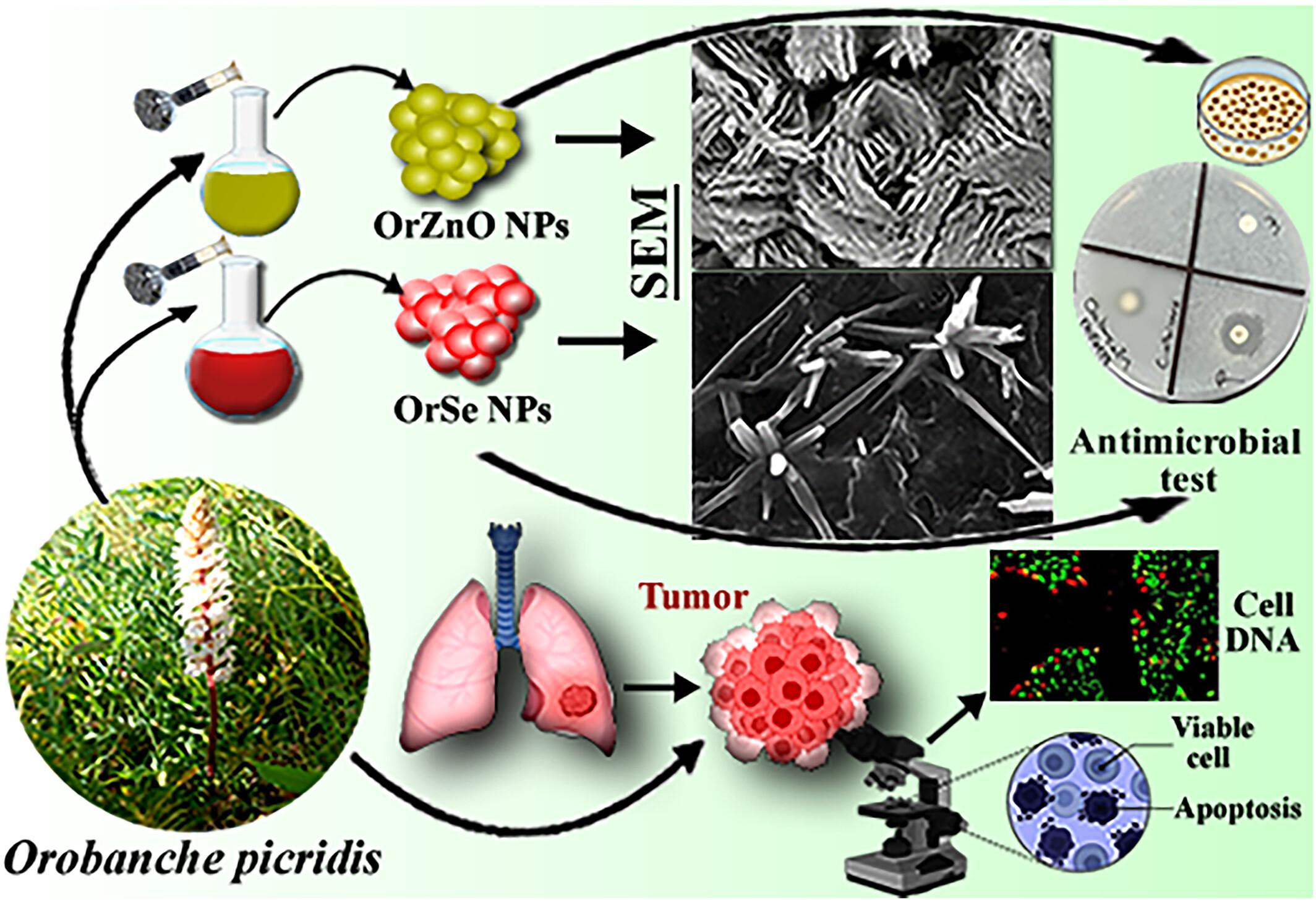 Cytotoxic Effect of Zinc Oxide and Selenium Nanoparticles Synthesized From Orobanche picridis on Lung Cancer as Well as Their Antimicrobial and Antioxidant Properties