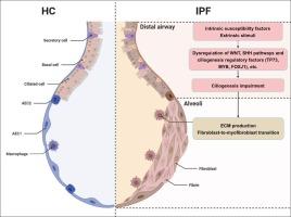 Impaired ciliogenesis in small airway epithelial cells involves in the development of idiopathic pulmonary fibrosis