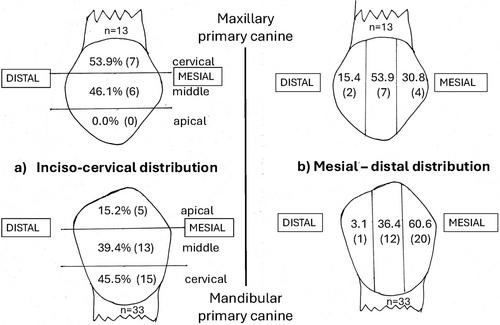 Primary Canine Hypoplasia in African American and Indonesian Children: Prevalence, Expression and Tooth Size