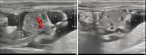 Meigs'-Like Syndrome Secondary to Remnant Ovarian Tissue in a Cat