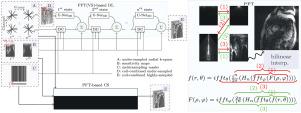 Accelerating cardiac radial-MRI: Fully polar based technique using compressed sensing and deep learning