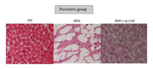 AMPK Activation and Lipid Homeostasis Regulation in MASLD: Investigating the Hepatoprotective and Anti-Inflammatory Effects of Meta-Capridin Medium-Chain Triglycerides