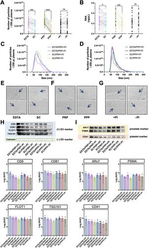 Plasma Preparation Strategies for Extracellular Vesicle-Based Biomarkers in Metastatic Castration-Resistant Prostate Cancer